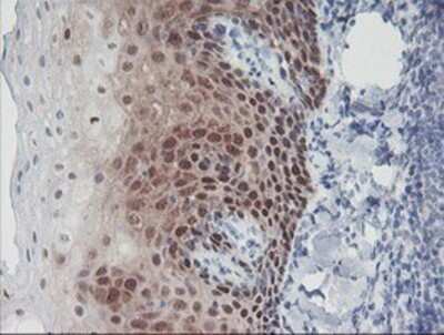 Immunohistochemistry: IRF6 Antibody (OTI2C10) - Azide and BSA Free [NBP2-71044]