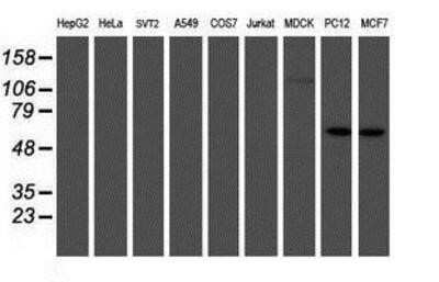 Western Blot: IRF6 Antibody (OTI2C10)Azide and BSA Free [NBP2-71044]