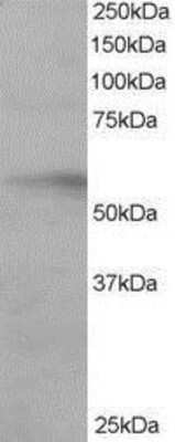 Western Blot: IRF6 Antibody [NBP1-51911]