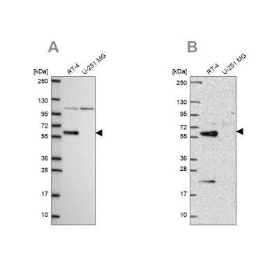 Western Blot: IRF6 Antibody [NBP2-55961]