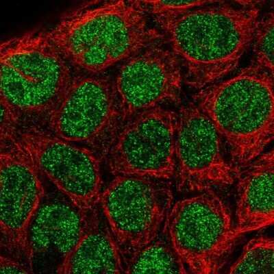 Immunocytochemistry/ Immunofluorescence: IRF8 Antibody [NBP1-81614]