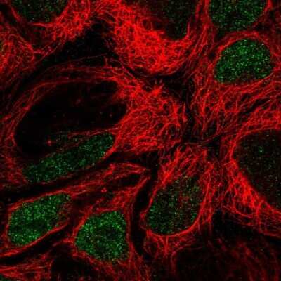 Immunocytochemistry/ Immunofluorescence: IRF8 Antibody [NBP1-83123]