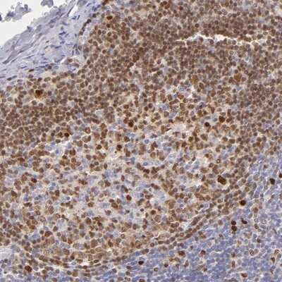 Immunohistochemistry-Paraffin: IRF8 Antibody [NBP1-83123]