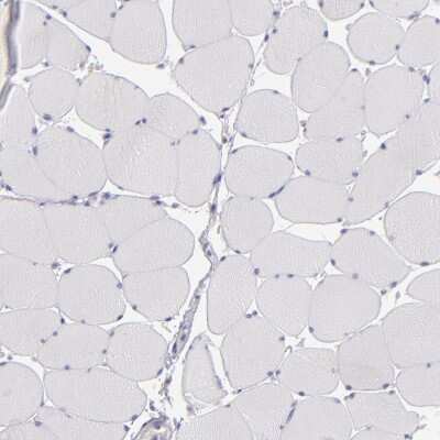 Immunohistochemistry-Paraffin: IRF8 Antibody [NBP1-83123]