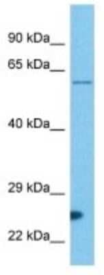 Western Blot: IRG1 Antibody [NBP3-10125]