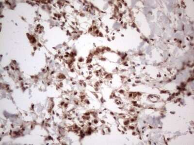 Immunohistochemistry: IRS1 Antibody (OTI3G10) [NBP2-45435]