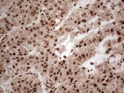 Immunohistochemistry: IRS1 Antibody (OTI3G10) [NBP2-45435]