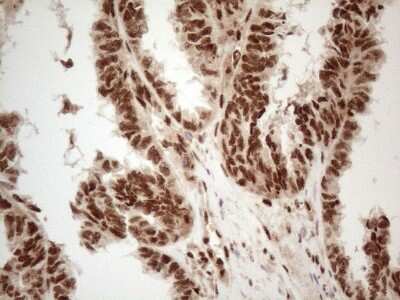 Immunohistochemistry: IRS1 Antibody (OTI3G10) [NBP2-45435]