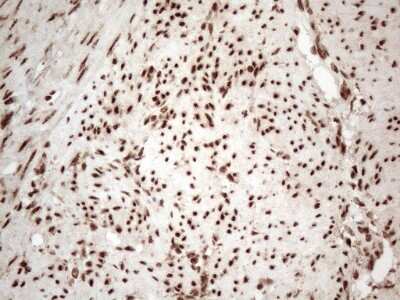 Immunohistochemistry: IRS1 Antibody (OTI3G10) [NBP2-45435]