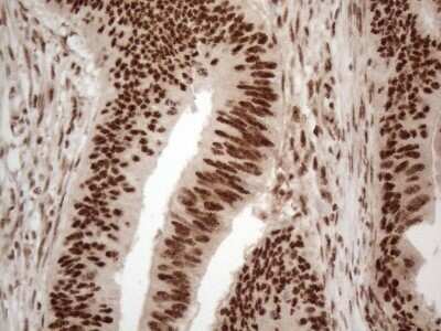Immunohistochemistry: IRS1 Antibody (OTI3G10) - Azide and BSA Free [NBP2-71049]