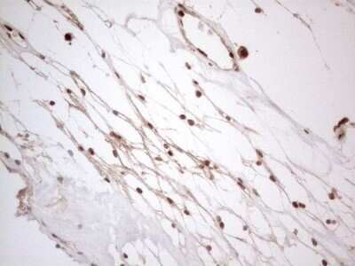 Immunohistochemistry: IRS1 Antibody (OTI3G10) - Azide and BSA Free [NBP2-71049]