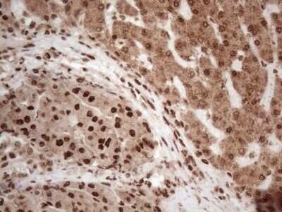 Immunohistochemistry: IRS1 Antibody (OTI3G10) - Azide and BSA Free [NBP2-71049]