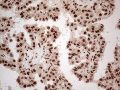 Immunohistochemistry: IRS1 Antibody (OTI3G10) - Azide and BSA Free [NBP2-71049]
