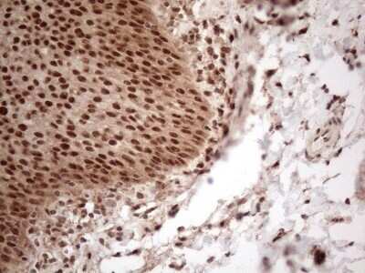 Immunohistochemistry: IRS1 Antibody (OTI3G10) - Azide and BSA Free [NBP2-71049]
