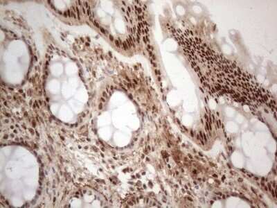 Immunohistochemistry: IRS1 Antibody (OTI3G10) - Azide and BSA Free [NBP2-71049]