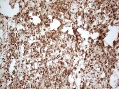 Immunohistochemistry: IRS1 Antibody (OTI3G10) - Azide and BSA Free [NBP2-71049]