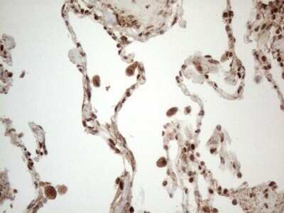 Immunohistochemistry: IRS1 Antibody (OTI3G10) - Azide and BSA Free [NBP2-71049]
