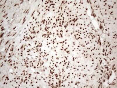 Immunohistochemistry: IRS1 Antibody (OTI3G10) - Azide and BSA Free [NBP2-71049]