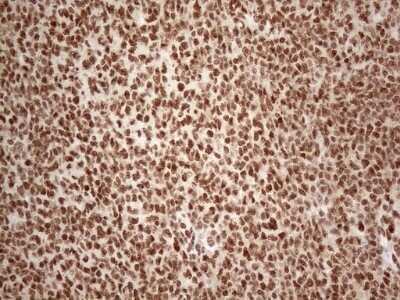 Immunohistochemistry: IRS1 Antibody (OTI3G10) - Azide and BSA Free [NBP2-71049]