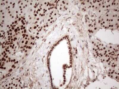 Immunohistochemistry: IRS1 Antibody (OTI3G10) - Azide and BSA Free [NBP2-71049]