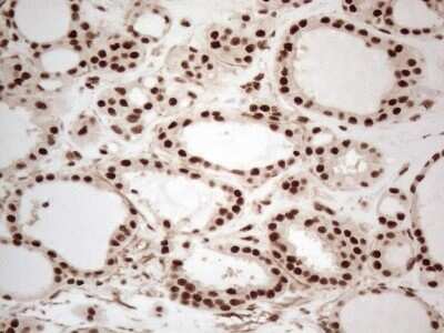 Immunohistochemistry: IRS1 Antibody (OTI3G10) - Azide and BSA Free [NBP2-71049]