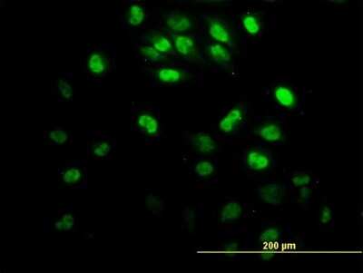 Immunocytochemistry/ Immunofluorescence: IRX3 Antibody (1D7) [H00079191-M05]