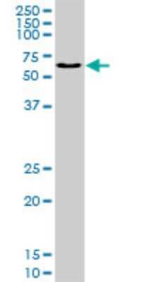 Western Blot: IRX3 Antibody (1D7) [H00079191-M05]