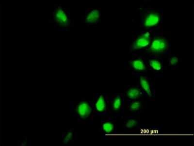 Immunocytochemistry/ Immunofluorescence: IRX3 Antibody (2H3) [H00079191-M08]
