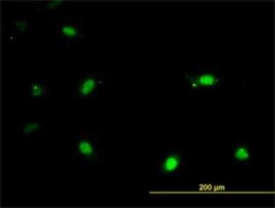 Immunocytochemistry/ Immunofluorescence: IRX3 Antibody (3D8) [H00079191-M03]