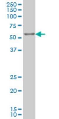 Western Blot: IRX3 Antibody (3D8) [H00079191-M03]
