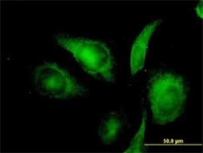 Immunocytochemistry/ Immunofluorescence: ISCU Antibody (3B8-1C4) [H00023479-M01]