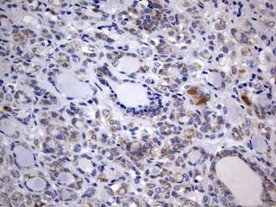 Immunohistochemistry: ISCU Antibody (OTI4F5) [NBP2-45436]