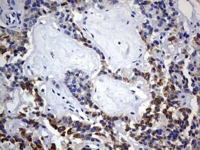 Immunohistochemistry: ISCU Antibody (OTI4F5) - Azide and BSA Free [NBP2-71742]