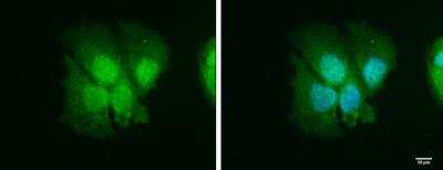 Immunocytochemistry/ Immunofluorescence: ISG15/UCRP Antibody [NBP2-16995]