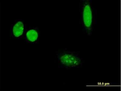 Immunocytochemistry/ Immunofluorescence: ISM2 Antibody [H00145501-B01P]