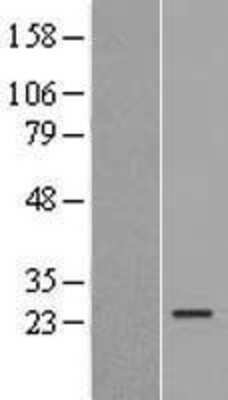 Western Blot: ISOC2 Overexpression Lysate [NBL1-12054]