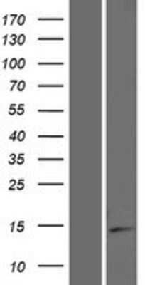 Western Blot: ISOC2 Overexpression Lysate [NBP2-09608]