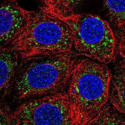 Immunocytochemistry/ Immunofluorescence: IST1 Antibody [NBP2-33720]