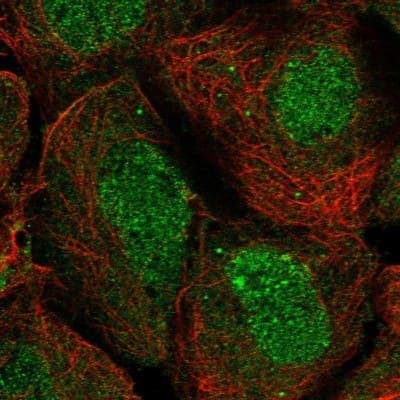 Immunocytochemistry/ Immunofluorescence: ISYNA1 Antibody [NBP2-47415]