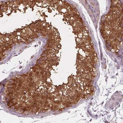 Immunohistochemistry-Paraffin: ISYNA1 Antibody [NBP2-47415]