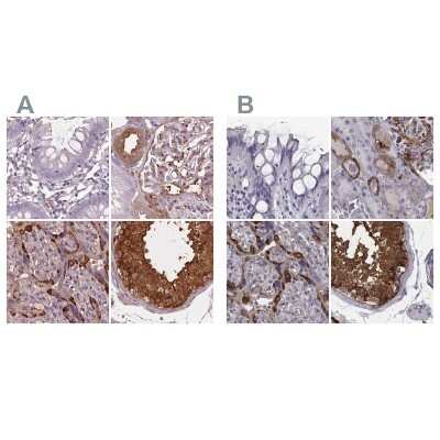 Immunohistochemistry-Paraffin: ISYNA1 Antibody [NBP2-47415]