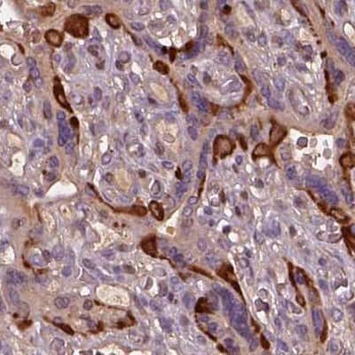 Immunohistochemistry-Paraffin: ISYNA1 Antibody [NBP2-47415]