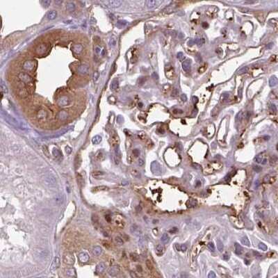 Immunohistochemistry-Paraffin: ISYNA1 Antibody [NBP2-47415]