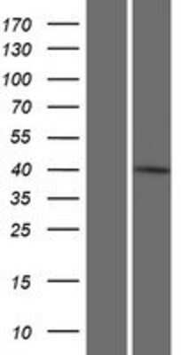 Western Blot: ITF46 Overexpression Lysate [NBP2-06685]