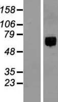 Western Blot: ITFG1 Overexpression Lysate [NBL1-12058]