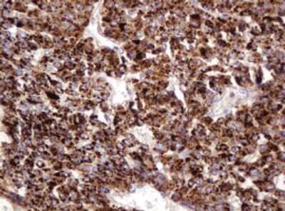 Immunohistochemistry: ITFG3 Antibody (OTI3B3) [NBP2-45766]