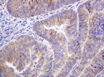 Immunohistochemistry: ITFG3 Antibody (OTI3B3) [NBP2-45766]