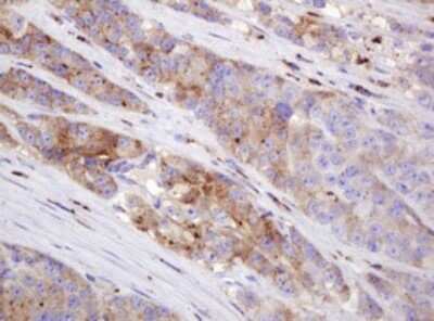 Immunohistochemistry: ITFG3 Antibody (OTI3B3) [NBP2-45766]