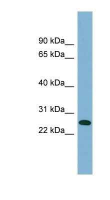 Western Blot: ITGB1BP3 Antibody [NBP1-53033]