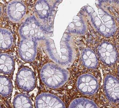 Immunohistochemistry-Paraffin: ITIH1 Antibody [NBP1-81782]